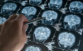 Terapia génica y los últimos avances de la ciencia Terapia génica